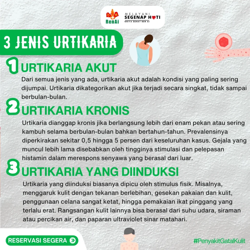 3 Jenis Penyakit Urtikaria