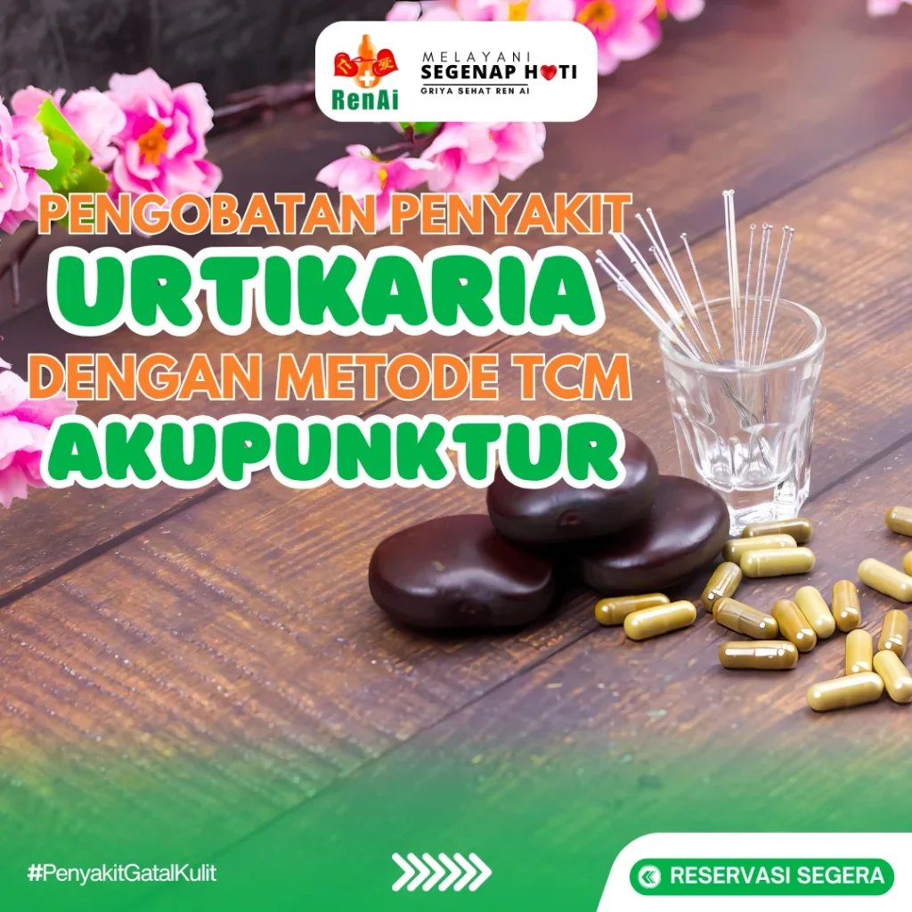 Pengobatan Urtikaria